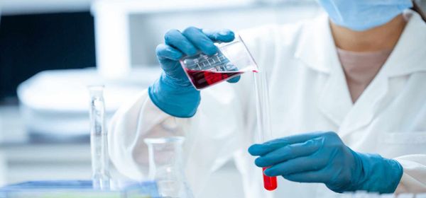 Puma Boardroom Shake-Up, Margin Pressure at BYD and Clinical Milestones at BioNxt Solutions